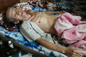 李文雄沒錢治病。