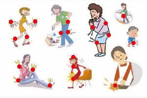 風濕性關節炎併發症有哪些？（示意圖源：互聯網）