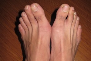 男人腎好壞看腳趾。（示意圖源：互聯網）