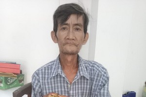 陳國峰的手又腫又腐爛。