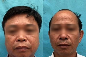 鄉黨委副書記、人民議會主席阮文良（左）和福城鄉醫療站長范鴻藍。（圖源：陳鋒）