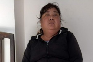 劉陳玉和的雙腳腫痛又潰瘍。