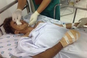 傷者獲送至醫院急救治療。（圖源：院方提供）