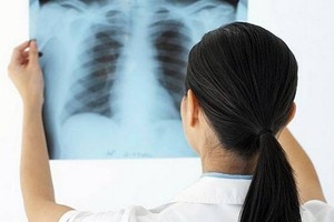 在越南，每年新結核患者約12萬4000人，1萬2000人因結核死亡。（示意圖源：互聯網）