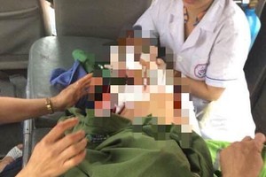 遭家養兇狗撲咬嚴重受傷的男童送醫院搶救無效身亡。（圖源：文全）