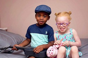 黑皮膚的男嬰卡姆西和白皮膚的女嬰卡奇。（圖源：CNA）