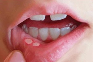 （示意圖源：互聯網）