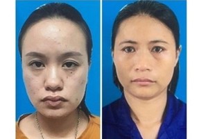 組織商業代孕嫌犯被起訴