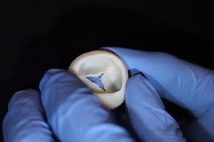 美國科學家們成功以膠原蛋白為原料，用3D生物印表機作出能在人體運作的心臟瓣膜。（圖源：Carnegie Mellon University ）