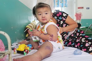 入住市第二兒童醫院接受治療中的一名病童。（圖源：丁姮）