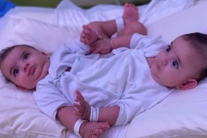 這對雙胞胎分別為艾哈邁德和穆罕默德。（圖源：互聯網）