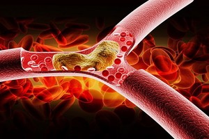 （示意圖源：互聯網） 