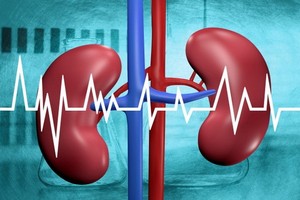 （示意圖源：互聯網）