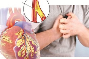 （示意圖源：互聯網）