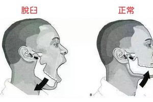 （示意圖源：互聯網）