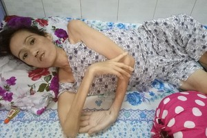 張秀冰病倒後身體消瘦，生活不能自理。