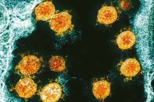 日本京都府立醫科大學研究小組日前公佈一項研究成果，稱新冠病毒一旦附著人體皮膚，其傳染性可至少持續9個小時。（圖源：AP）