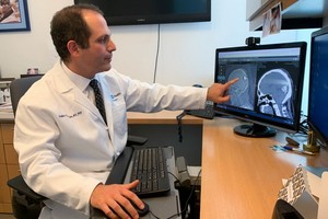 賓夕法尼亞大學佩雷爾曼醫學院神經外科主任Daniel Yoshor 基於此參與設計了大腦植入物刺激視覺皮層的方法。（圖源：互聯網）