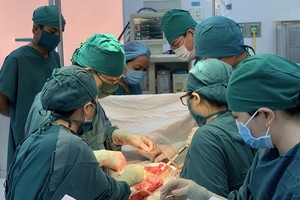 手術團隊為患者進行腹部腫瘤切除術。（圖源：仲大）