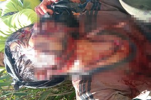 傷者胡文會遭野熊攻擊，傷勢十分嚴重。（圖源：黃君）