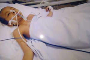 趙何順小弟弟左腦嚴重震傷。