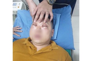 因切洋蔥不巧誘發過敏性休克的男子。（圖源：院方提供）