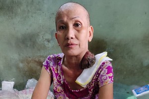 吳玉鳳接受化療後，腫瘤開始變小了。