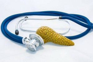 胰腺癌“偏愛”這４類人！