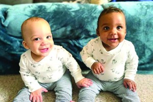 美夫妻生育一黑一白雙胞胎