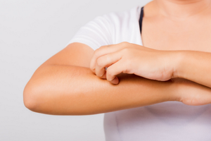 注意加強預防皮膚癌“元兇”措施