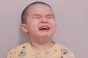 在支氣管找到小孩乳牙