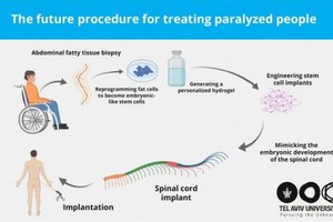 3D 脊髓組織或讓癱瘓者重新行走