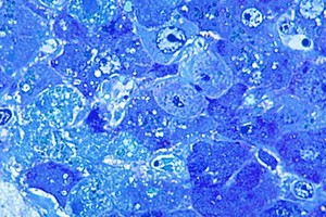 拉沙熱病毒。（圖：互聯網）