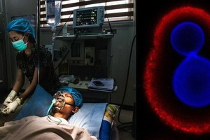 真菌病原體越來越常見，而且對治療藥物的耐藥性越來越強，對公共衛生構成了重大威脅。（示意圖：聯合國）