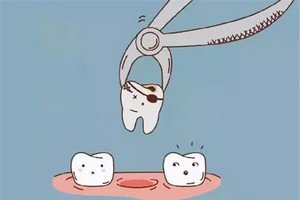 拔牙後３個時間點很關鍵！