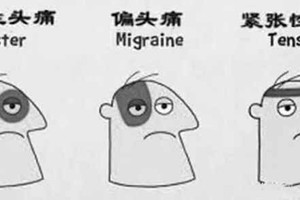 ５招應對叢集性頭痛