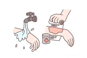 被燙傷後該如何處理？