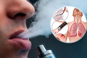 电子烟危害多与后患无穷 