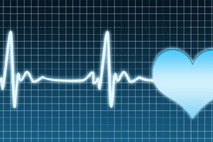 心慌、乏力、胸闷，可能是室速在作怪！