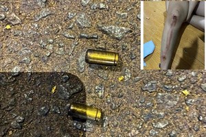 掉落在事发现场的弹壳及中枪者的脚上伤势（小图）。（图：CTV）