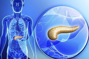 你真的了解胰腺癌吗？