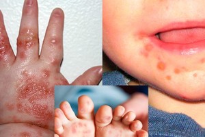 （示意图：互联网）