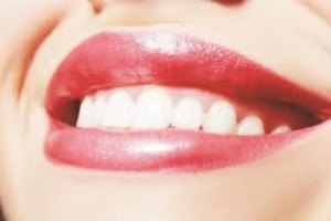 龅牙、嘴凸、露龈笑应该选正颌还是正畸？