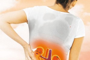 结石有４警讯 补钙１习惯增结石风险