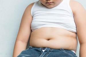 孩子小心吃出“甜蜜负担”