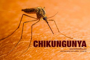 基孔肯雅热是由蚊子传播病毒所引起的疾病。（示意图：互联网）