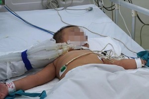 一名重症手足口病童住院接受治疗。（图：KD）