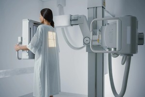 透过胸片估测患者年龄