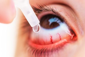 （示意图：互联网）