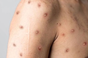 （示意图：互联网）